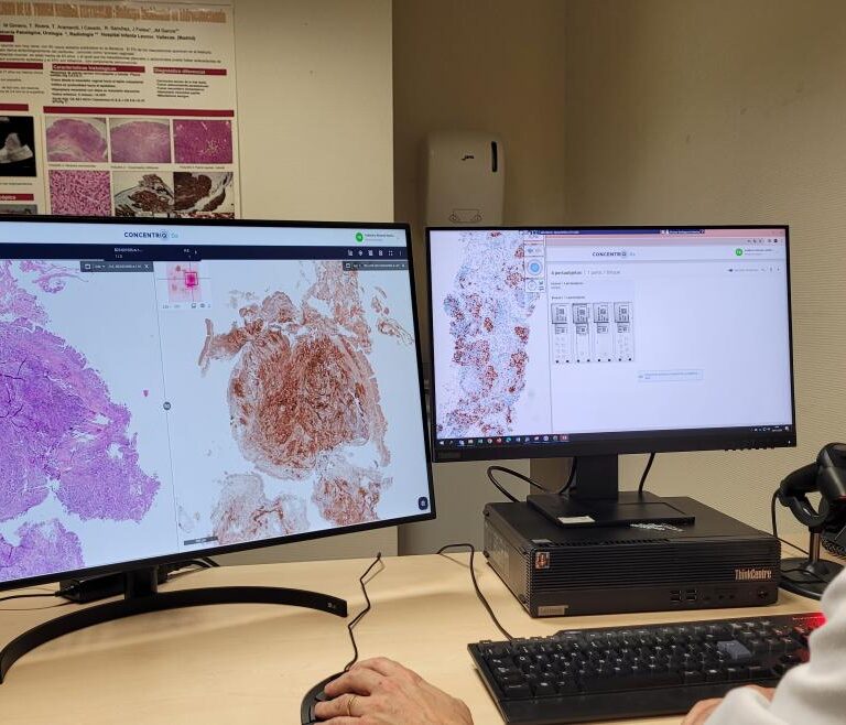 El Hospital Infanta Leonor implanta un sistema de patología digital completo para optimizar el diagnóstico